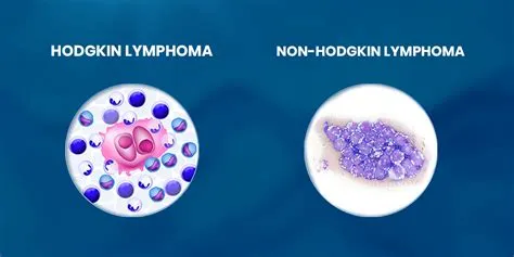 नॉन-हॉजकिन लिम्फोमा (Non-Hodgkin's Lymphoma)
