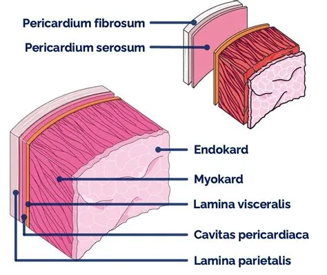 पेरीकार्डिटिस (Pericarditis - हृदय की झिल्ली की सूजन)