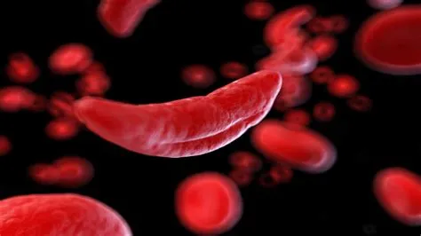 पैनसाइटोपेनिया (Pancytopenia - सभी रक्त कोशिकाओं की कमी)