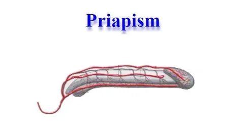 प्राइपिज्म (Priapism)