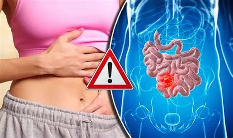 फेकल इम्पैक्शन (Fecal Impaction - गंभीर कब्ज और मल का अटकना)