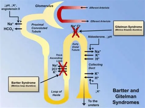 बार्टर सिंड्रोम (Bartter Syndrome - किडनी का आनुवंशिक विकार)