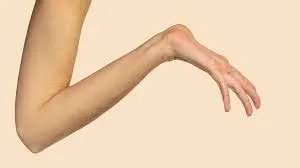 मार्फन सिंड्रोम (Marfan Syndrome)
