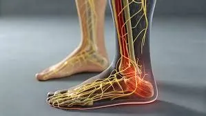 रेस्टलेस लेग सिंड्रोम (Restless Legs Syndrome - RLS - पैरों में बेचैनी)