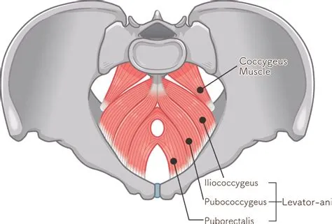लेवेटर एनी सिंड्रोम (Levator Ani Syndrome - पेल्विक फ्लोर की मांसपेशियों का दर्द)