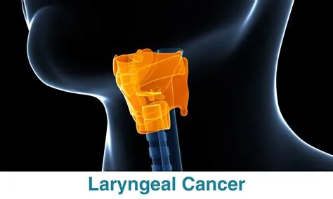 लैरिंजियल कैंसर (Laryngeal Cancer - स्वरयंत्र का कैंसर)