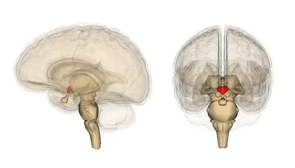 वर्निक एन्सेफेलोपैथी (Wernicke Encephalopathy - विटामिन B1 की कमी से भ्रम)