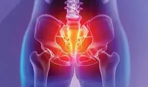 वल्वोडायनिया (Vulvodynia - योनि के बाहरी हिस्से में क्रोनिक, बिना कारण का दर्द)