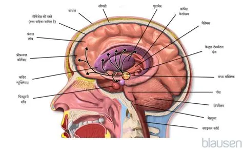 सिरिंगोबुलबिया (Syringobulbia - मस्तिष्क के तने में सिस्ट)