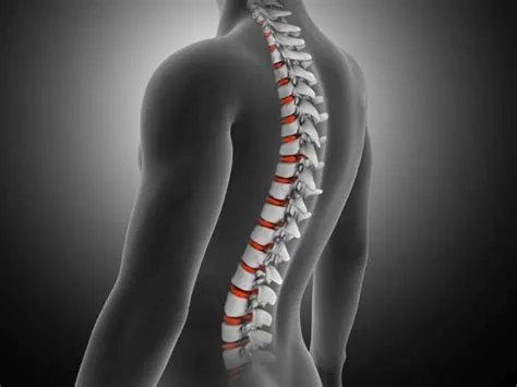 सिरिंगोमेलिया (Syringomyelia - रीढ़ की हड्डी में सिस्ट बनना)