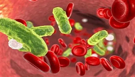 सेप्टिक शॉक (Septic Shock - रक्त संक्रमण से ब्लड प्रेशर का खतरनाक रूप से गिरना)