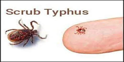 स्क्रब टाइफस (Scrub Typhus)