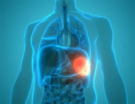 स्प्लेनोमेगाली (Splenomegaly - तिल्ली / प्लीहा का बढ़ना)