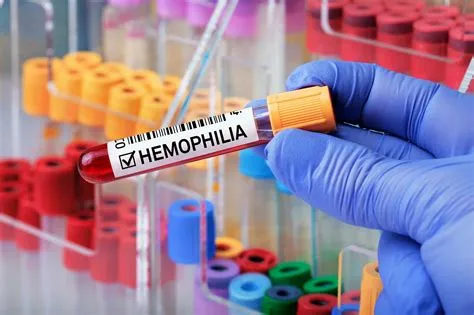 हीमोफिलिया (Hemophilia A, B, C)