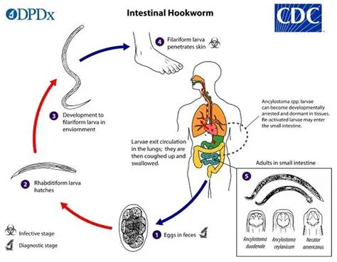 हुकवर्म संक्रमण (Hookworm Infection)