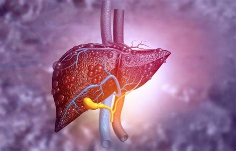 हेपेटिक वेनो-ओक्लूसिव रोग (Hepatic Veno-Occlusive Disease)