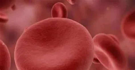 हेरेडिटरी स्फेरोसाइटोसिस (Hereditary Spherocytosis - लाल रक्त कोशिकाओं का गोल होना)