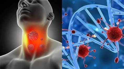 हॉजकिन लिम्फोमा (Hodgkin's Lymphoma - लिम्फ नोड्स का कैंसर)