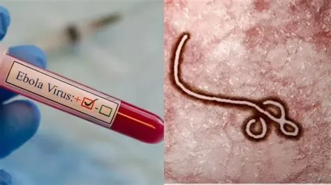 इबोला वायरस रोग