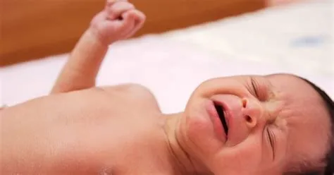 लैरींगोमालेशिया (Laryngomalacia - शिशुओं में श्वासनली का मुलायम होना)