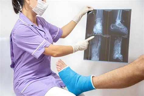 स्ट्रेस फ्रैक्चर (Stress Fracture - अत्यधिक दबाव से हड्डियों में बालों जैसी दरार)