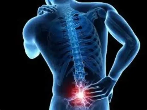 स्पॉन्डिलोलिस्थीसिस (Spondylolisthesis - रीढ़ की हड्डी का अपनी जगह से खिसकना)